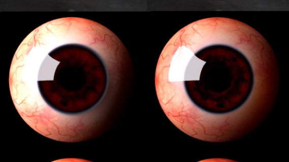 eyeTest01
